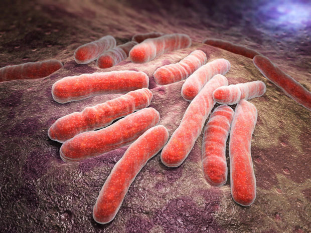 tubercolosis
